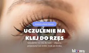 Czerwone, podrażnione oko z widocznym uczuleniem na klej do rzęs. Artykuł omawia objawy i przyczyny.