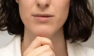 Kobieta zamyślona, dotykająca podbródka. W jej spojrzeniu widać brak akceptacji swojego wyglądu, mimo naturalnej urody.