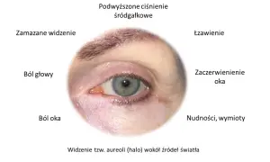 Ile trwa atak jaskry? Działaj szybko, by ratować wzrok!