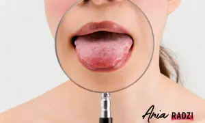 Powiększony pypeć na języku, widoczny pod lupą. Ania radzi, jak dbać o zdrowie jamy ustnej.