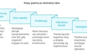 Jak długo goi się dziąsło po wyrwaniu zęba i jak uniknąć powikłań?