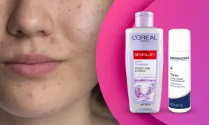 Viso con imperfezioni e due flaconi di tonico, uno L'Oréal Revitalift, l'altro Dermasence, per una pelle giovane e luminosa.