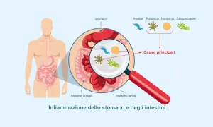 Illustrazione dell'apparato digerente con ingrandimento che mostra i microrganismi causa di gastroenterite sintomi.