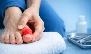 Eine Hand berührt einen roten, entzündeten Zeh, der starke Schmerzen in den Zehen signalisiert. Ein Handtuch und medizinische Instrumente liegen bereit.