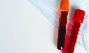 Dwie probówki z krwią na tle maseczki ochronnej. Wyniki badań, w tym egfr norma, czekają na analizę.
