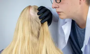 Lekarz od włosów w czarnej rękawiczce bada blond włosy pacjentki, oceniając ich kondycję.