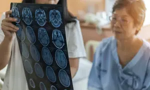 Lekarz pokazuje pacjentce rezonans magnetyczny mózgu, na którym widoczny jest guz.