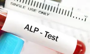 Podwyższona fosfataza alkaliczna: Co oznacza? Przyczyny i kroki