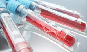 Blodprovsrör med rött blod och DNA-spiral. Kan användas för att identifiera blodgrupp.