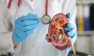 Urolog: Kiedy wizyta? Objawy, choroby, badanie co musisz wiedzieć