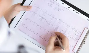 Ręka z długopisem wskazuje na zapis EKG, pomagając zrozumieć, jak odczytać wynik ekg.