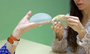Une main présente un implant mammaire, tandis qu'une autre femme examine un implant différent. Discussion sur la réduction mammaire.