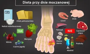 Dieta przy dnie moczanowej: TAK - nabiał, wiśnie, jagody, warzywa. NIE - czerwone mięso, podroby, alkohol. Milurit 100 może pomóc.