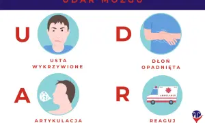 Udar: Ile trwa pobyt w szpitalu? Wszystko, co musisz wiedzieć.