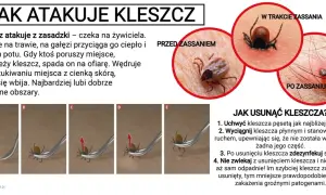 Szary kleszcz przed i w trakcie wgryzania się w skórę. Obok instrukcja usuwania kleszcza.