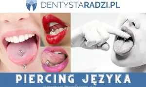 Kolczyk w języku: zobacz, jak to wygląda i dowiedz się, ile goi się kolczyk w języku. Bezpieczeństwo przede wszystkim!