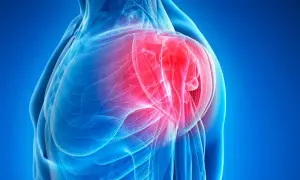 Anatomical illustration of a shoulder with inflamed bursa highlighted in red.