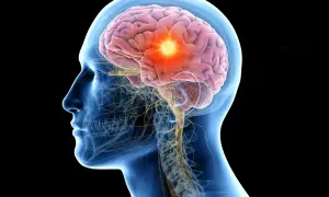 Ilustracja mózgu z podświetlonym obszarem, symbolizującym choroby neurologiczne.