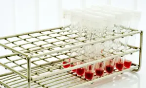 Rząd probówek z czerwoną surowicą w metalowym stojaku laboratoryjnym.