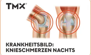 Anatomische Darstellung von Kniegelenken, die **Knieschmerzen nachts** thematisieren.