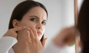 Ragazza preoccupata che si tocca un puntino nero sulla pelle del viso riflesso nello specchio.