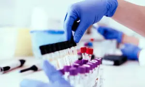 Ręce w niebieskich rękawiczkach przygotowują probówki do analizy. To ważny etap w procesie, jakim jest test na narkotyki.