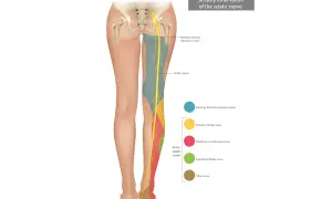 Illustrazione anatomica che mostra l'innervazione sensoriale del nervo sciatico, utile per comprendere le cause del dolore al nervo sciatico.