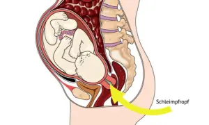 Der Schleimpfropf löst sich – ein Zeichen, dass die Geburt bald los geht. Das Baby liegt bereit im Mutterleib.