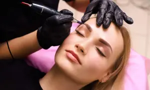 Ile zabiegów epilacji laserowej? Odkryj sekrety trwałej gładkości!