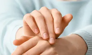 Czy hybryda uczula? Objawy alergii i jak ich uniknąć