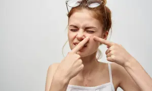 Ragazza con occhiali in testa che si tocca un brufolo, un fastidioso punto nero che si riforma sempre.