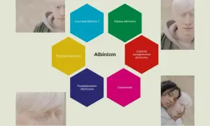 Grafika przedstawia schemat informacyjny o albinizmie, z portretami osób z albinizmem.