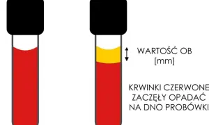 Skrzep w próbce krwi: Błąd czy choroba? Zrozum swój wynik