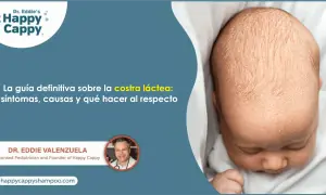 Bebé con costra láctea. Guía definitiva sobre síntomas, causas y tratamiento de la costra láctea. Dr. Eddie Valenzuela.