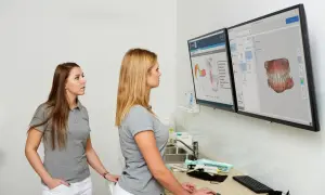 Dwie kobiety w szarych koszulkach analizują na monitorach modele zębów i schematy. Zastanawiają się, ile kosztuje wymiana plomby.