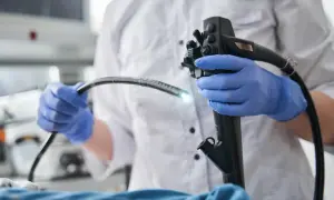 Lekarz w niebieskich rękawiczkach trzyma endoskop. W Warszawie NFZ oferuje kolonoskopię i gastroskopię w znieczuleniu ogólnym.