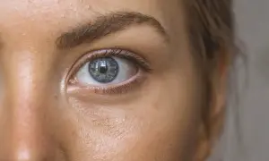 Zbliżenie na niebieskie oko z widocznymi prosakami na skórze. Szukasz skutecznego leku na prosaki bez recepty?