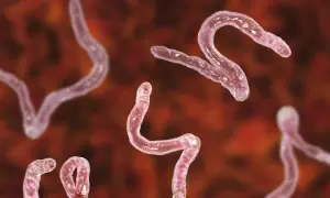 Różowe, wijące się pasożyty, przypominające kształtem literę S, to giardia.
