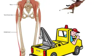 Anatomia della bandelletta ileotibiale e muscoli correlati. Un cavallino in posa e un carro attrezzi sorridente suggeriscono esercizi per la bandelletta ileotibiale.