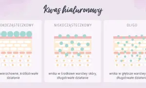 Kwas hialuronowy jaki najlepszy - porównanie skutecznych produktów