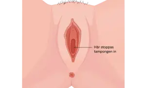 Illustration av en kvinnas underliv. En pil pekar in i vaginan med texten "Här stoppas tampongen in". Kan vara relevant vid diskussion om svamp i underlivet gravid.