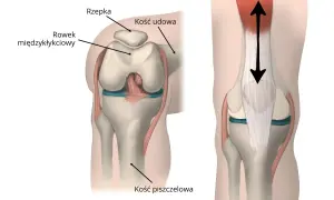 Ilustracja anatomiczna stawu kolanowego z zaznaczoną rzepką, kością udową i piszczelową.
