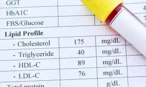 Wynik lipidogramu: cholesterol całkowity 175, trójglicerydy 40, HDL 89, LDL-C 76. Wynik ten pokazuje, że cholesterol nie HDL jest w normie.
