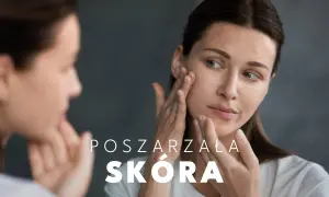Kobieta z uwagą ogląda swoją poszarzałą cerę w lustrze, dotykając policzka.