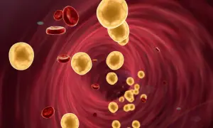 Jak obniżyć cholesterol na diecie keto? Skuteczne strategie i porady