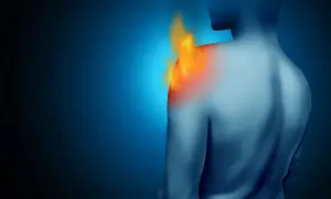 Schulteransicht mit Flammen, die den entzündeten Schleimbeutel in der Schulter symbolisieren.