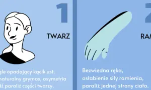 Objawy wylewu u starszej osoby – jak je rozpoznać i działać natychmiast