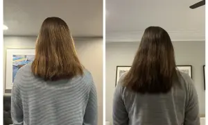 Due immagini affiancate mostrano i capelli di una persona, che sembrano non crescere.