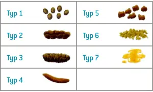 Classificazione delle scorie alimentari: da grumi separati a feci liquide, ogni tipo indica qualcosa.