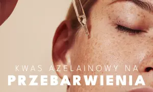 Kwas azelainowy na przebarwienia. Kropla serum z kwasem azelainowym na skórze z piegami.
